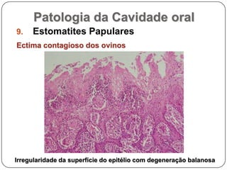 Patologia da Cavidade oralEstomatites PapularesEctima contagioso dos ovinosIrregularidade da superfície do epitélio com degeneração balanosa