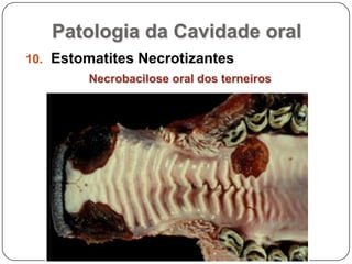 Patologia da Cavidade oralEstomatites NecrotizantesNecrobacilose oral dos terneiros
