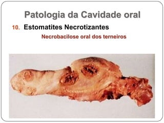 Patologia da Cavidade oralEstomatites NecrotizantesNecrobacilose oral dos terneiros