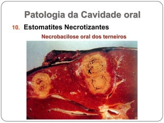 Patologia da Cavidade oralEstomatites NecrotizantesNecrobacilose oral dos terneiros