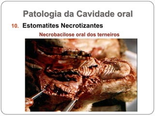 Patologia da Cavidade oralEstomatites NecrotizantesNecrobacilose oral dos terneiros