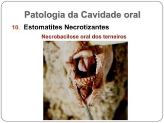 Patologia da Cavidade oralEstomatites NecrotizantesNecrobacilose oral dos terneiros