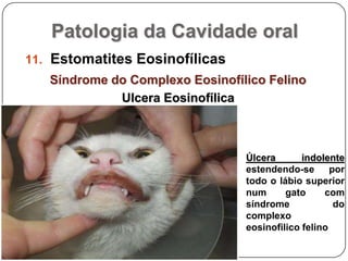 Patologia da Cavidade oralEstomatites EosinofílicasSíndrome do Complexo Eosinofílico FelinoUlcera EosinofílicaÚlcera indolente estendendo-se por todo o lábio superior num gato com síndrome do complexo eosinofilico felino