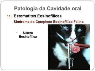 Patologia da Cavidade oralEstomatites EosinofílicasSíndrome do Complexo Eosinofílico FelinoUlcera EosinofílicaPatologia da Cavidade oralEstomatites EosinofílicasSíndrome do Complexo Eosinofílico FelinoPlaca Eosinofílica (PE):placas alopécicas em relevo, circunscritas e freqüentemente múltiplas. podem tornar-se ulceradas e exsudativas.localizam-se no abdômen (80%) e na face interna das coxas. são acompanhadas de prurido intenso. 