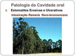 Patologia da Cavidade oralEstomatites Erosivas e UlcerativasIntoxicação Ramaria  flavo-brunnencens