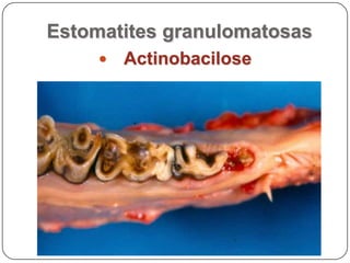 Estomatites granulomatosasActinobacilose