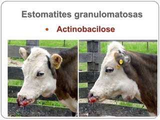 Estomatites granulomatosasActinobacilose