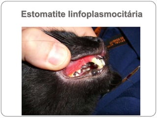 Estomatite linfoplasmocitária