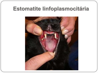 Estomatite linfoplasmocitária