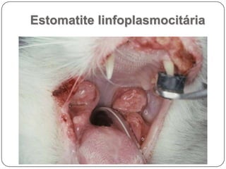 Patologia da Cavidade OralIntroduçãoEstrutura e funçãoMecanismos de defesaAnomalias do desenvolvimentoEstomatites e gengivitesEstomatites vesicularesDoenças vesiculares especificasEstomatites erosivas e ulcerativasEstomatites papulares