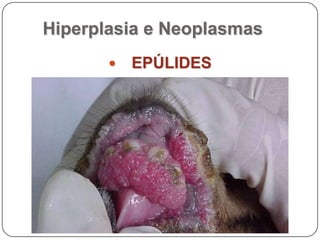 Hiperplasia e NeoplasmasEPÚLIDES