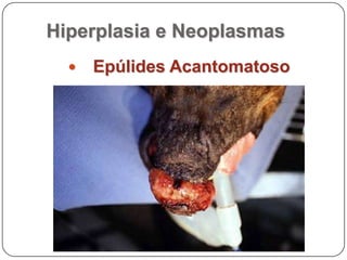 Hiperplasia e NeoplasmasCarcinoma células escamosas