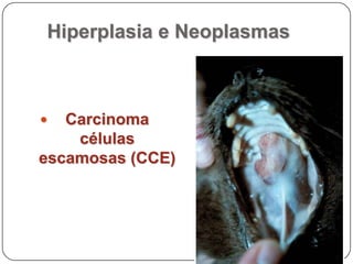 Hiperplasia e NeoplasmasCarcinoma células escamosas (CCE)