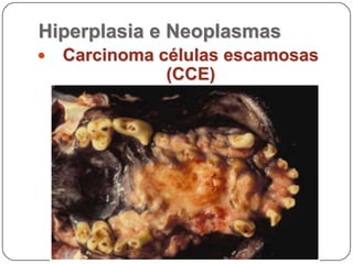 Hiperplasia e NeoplasmasCa células escamosas (CCE)Intox. Samambaia