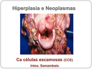 Hiperplasia e NeoplasmasMelanomas oral