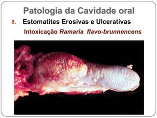 Patologia da Cavidade oralEstomatites Erosivas e UlcerativasIntoxicação Ramaria  flavo-brunnencens