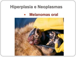 Hiperplasia e NeoplasmasMelanoma oral