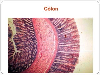 Cólon