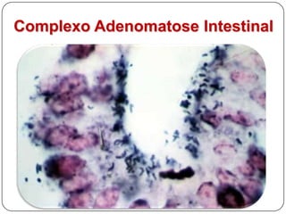 Inflamações:Tipo de ExsudatoHemorrágicaCatarralGranulomatosa / ProliferativaUlcerativa / necrotizanteParasitária