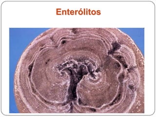 Enterólitos