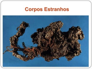 Patologias dos IntestinosObstrução intestinalImpactação e enterólitosObstrução por corpo estranhoIntussuscepção