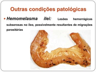 Outras condições patológicasHemomelasma ilei: