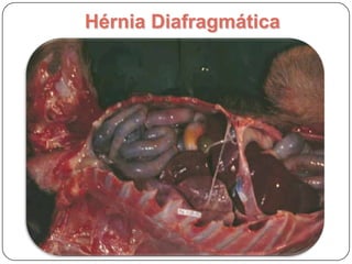 Alterações vasculares do IntestinoParasitariaVasculite parasitáriaStrongylusvulgaris