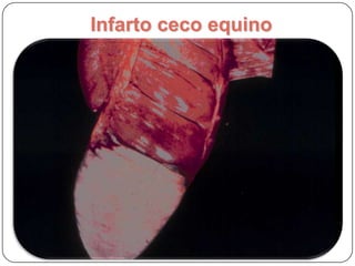 Infarto jejuno humano