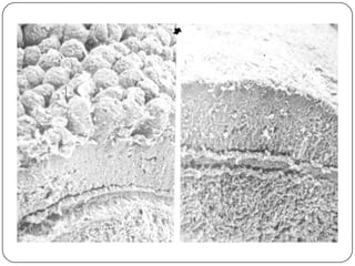 Enterite Hemorrágica - Canino