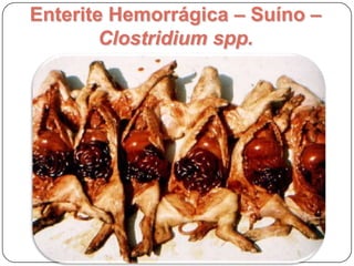 Inflamações:Tipo de ExsudatoHemorrágicaCatarralGranulomatosa / ProliferativaUlcerativa / necrotizante