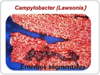 Complexo Adenomatose Intestinal