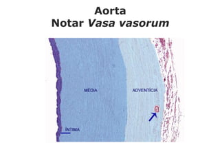 Aorta
Notar Vasa vasorum
 