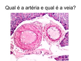 Qual é a artéria e qual é a veia?
 
