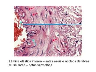 Lâmina elástica interna – setas azuis e núcleos de fibras
musculares – setas vermelhas
 