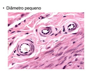 • Diâmetro pequeno
 