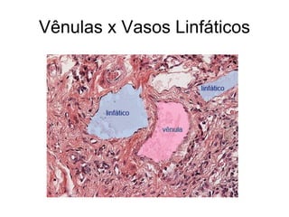 Vênulas x Vasos Linfáticos
 