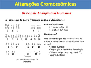 Principais Aneuploidias Humanas
a) Síndrome de Down (Trissomia do 21 ou Mongolismo)
3 cromossomos no par 21
Trissomia
Cariótipos possíveis
 Homem: 45A + XY
 Mulher: 45A + XX
O que causa?
Erro na distribuição dos cromossomos na
formação dos gametas (espermatozóides e
óvulos)
 Idade avançada
 Exposição a altas taxas de radiação
 Uso de drogas alucinógenas (LSD,
Heroína, Ecstasy)
Alterações Cromossômicas
 