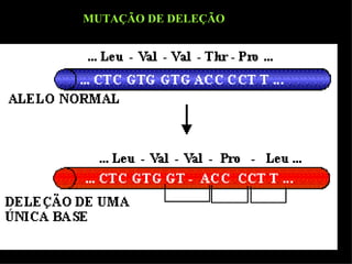 MUTAÇÃO DE DELEÇÃO 