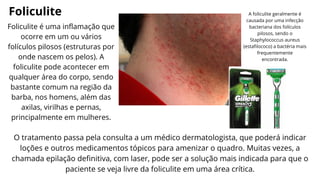 Foliculite
Foliculite é uma inflamação que
ocorre em um ou vários
folículos pilosos (estruturas por
onde nascem os pelos). A
foliculite pode acontecer em
qualquer área do corpo, sendo
bastante comum na região da
barba, nos homens, além das
axilas, virilhas e pernas,
principalmente em mulheres.
A foliculite geralmente é
causada por uma infecção
bacteriana dos folículos
pilosos, sendo o
Staphylococcus aureus
(estafilococo) a bactéria mais
frequentemente
encontrada.
O tratamento passa pela consulta a um médico dermatologista, que poderá indicar
loções e outros medicamentos tópicos para amenizar o quadro. Muitas vezes, a
chamada epilação definitiva, com laser, pode ser a solução mais indicada para que o
paciente se veja livre da foliculite em uma área crítica.
 