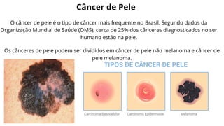 Câncer de Pele
O câncer de pele é o tipo de câncer mais frequente no Brasil. Segundo dados da
Organização Mundial de Saúde (OMS), cerca de 25% dos cânceres diagnosticados no ser
humano estão na pele.
Os cânceres de pele podem ser divididos em câncer de pele não melanoma e câncer de
pele melanoma.
 