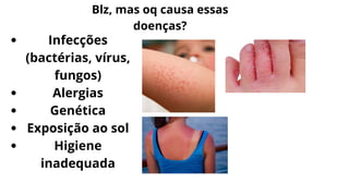 Infecções
(bactérias, vírus,
fungos)
Alergias
Genética
Exposição ao sol
Higiene
inadequada
Blz, mas oq causa essas
doenças?
 