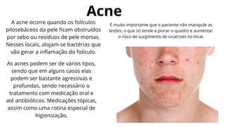 Acne
A acne ocorre quando os folículos
pilosebáceos da pele ficam obstruídos
por sebo ou resíduos de pele mortas.
Nesses locais, alojam-se bactérias que
vão gerar a inflamação do folículo.
As acnes podem ser de vários tipos,
sendo que em alguns casos elas
podem ser bastante agressivas e
profundas, sendo necessário o
tratamento com medicação oral e
até antibióticos. Medicações tópicas,
assim como uma rotina especial de
higienização,
É muito importante que o paciente não manipule as
lesões, o que só tende a piorar o quadro e aumentar
o risco de surgimento de cicatrizes no local.
 