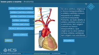 10
ARCO AÓRTICO
TRONCO BRAQUIOCEFÁLICO
ARTÉRIA SUBCLÁVIA
ARTÉRIA VERTEBRAL
ARTÉRIA CARÓTIDA COMUM
ARTÉRIA CARÓTIDA INTERNA
ARTÉRIA CARÓTIDA EXTERNA
DIREITO ESQUERDO
Do arco aórtico, origina-se
o tronco braquiocefálico,
a artéria carótida comum
esquerda e a artéria
subclávia esquerda.
Portanto, do lado direito a
artéria carótida comum e
a subclávia, tem origem
comum no tronco
braquicefalico, que
origina-se no arco aórtico
Ambas artérias vertebrais
tem origem nas subclávias.
bases para o exame - Anatomia
Dr. Carlos Stéfano Hoffmann Britto @drcarlosstefano stefanobritto@hotmail.com (31) 98799-0405
 