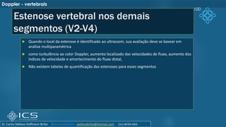 Estenose vertebral nos demais
segmentos (V2-V4)
 Quando o local da estenose é identificado ao ultrassom, sua avaliação deve se basear em
análise multiparamétrica
 como turbulência ao color Doppler, aumento localizado das velocidades de fluxo, aumento dos
índices de velocidade e amortecimento do fluxo distal,
 Não existem tabelas de quantificação das estenoses para esses segmentos
100
Doppler - vertebrais
Dr. Carlos Stéfano Hoffmann Britto @drcarlosstefano stefanobritto@hotmail.com (31) 98799-0405
 