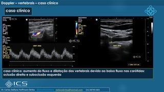 Doppler – vertebrais – caso clínico
caso clínico
caso clínico: aumento do fluxo e dilatação das vertebrais devido ao baixo fluxo nas carótidas:
oclusão direita e suboclusão esquerda
Dr. Carlos Stéfano Hoffmann Britto @drcarlosstefano stefanobritto@hotmail.com (31) 98799-0405
 