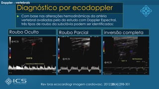 Diagnóstico por ecodoppler
 Com base nas alterações hemodinâmicas da artéria
vertebral avaliadas pelo do estudo com Doppler Espectral,
três tipos de roubo da subclávia podem ser identificados:
Rev bras ecocardiogr imagem cardiovasc. 2012;25(4):298-301
Roubo Oculto Roubo Parcial inversão completa
Doppler - vertebrais
 