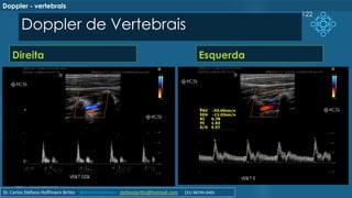 Doppler de Vertebrais
Direita Esquerda
122
Doppler - vertebrais
Dr. Carlos Stéfano Hoffmann Britto @drcarlosstefano stefanobritto@hotmail.com (31) 98799-0405
 