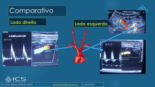 Comparativo
Lado direito Lado esquerdo
Dr. Carlos Stéfano Hoffmann Britto @drcarlosstefano stefanobritto@hotmail.com (31) 98799-0405
 