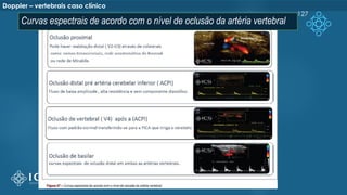 127
Doppler – vertebrais caso clínico
Curvas espectrais de acordo com o nível de oclusão da artéria vertebral
 