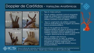 Doppler de Carótidas - Variações Anatômicas
1. Tipo A: mais comum.
2. Tipo B: artéria carótida comum esquerda
surge da artéria tronco braquiocefálico,
assim como a artéria subclávia direita e
artéria carótida comum direita.
3. Tipo C: surgimento da artéria carótida
comum esquerda junto à origem da artéria
tronco braquiocefálico.
4. Tipo D: há ausência da tronco
braquiocefálico em que os quatros ramos –
artérias subclávia direita e esquerda e
artérias carótida comum direita e esquerda
- surgem diretamente do arco aórtico.
5. Tipo E: existem dois troncos
braquiocefálicos, ou seja, as artérias
subclávia esquerda e carótida comum
esquerda se origina originam da
ramificação da segunda artéria tronco
braquiocefálico.
13
Tipos e índices de variações anatômicas encontradas no Laboratório de Anatomia Humana
da Universidade de Rio Verde – FESURV (tipo A 78,9%; B 10,5%; C 5,3% e D 5,3%).
 